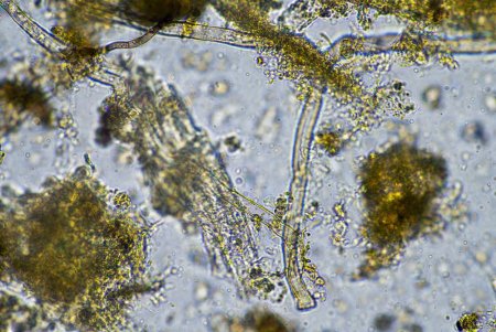 How Bacteria Can Be Beneficial to a Pond’s Ecosystem